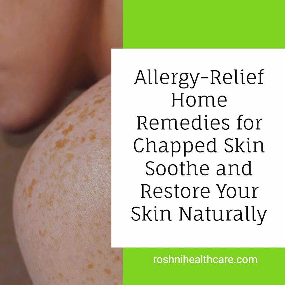 Home Remedies for Relieving Allergy-Related Chapped or Dry Skin